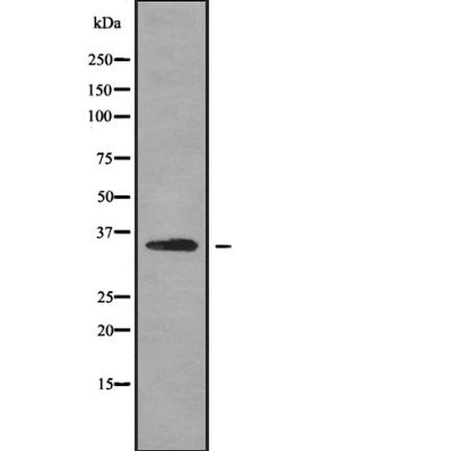 OR2G6 Antibody in Western Blot (WB)