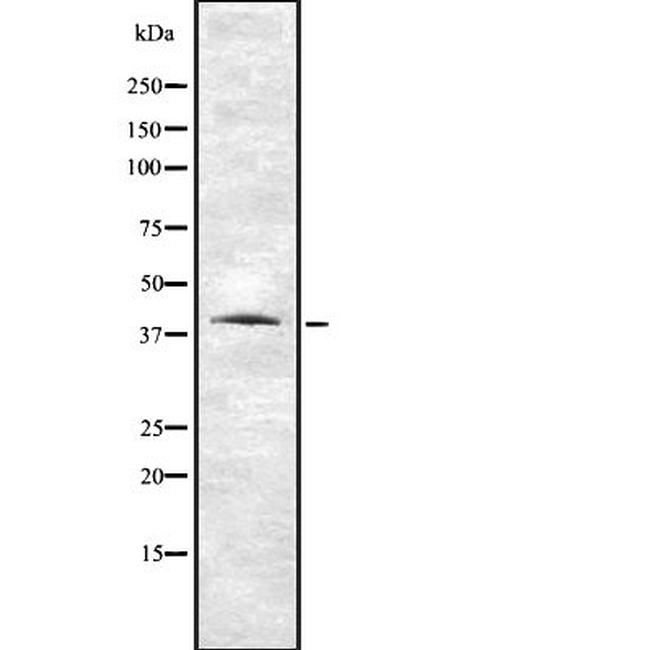 VN1R1 Antibody in Western Blot (WB)