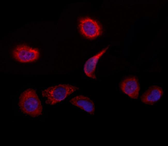 C2orf33 Antibody in Immunocytochemistry (ICC/IF)