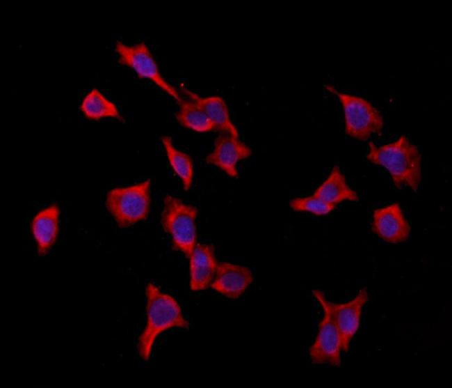 VPRBP Antibody in Immunocytochemistry (ICC/IF)