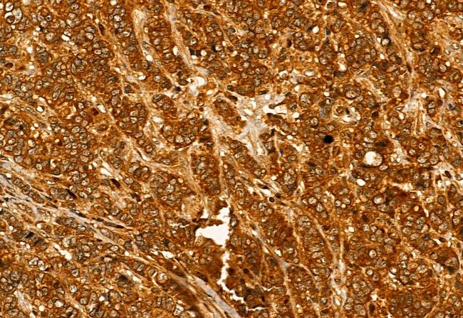 Pallidin Antibody in Immunohistochemistry (Paraffin) (IHC (P))