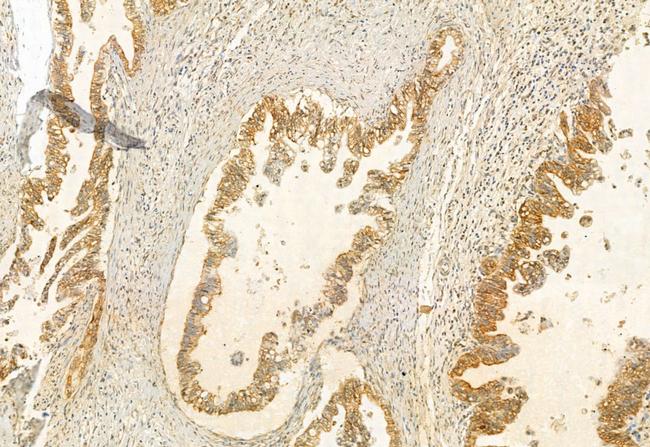 UBAP1 Antibody in Immunohistochemistry (Paraffin) (IHC (P))