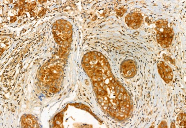 GDI2 Antibody in Immunohistochemistry (Paraffin) (IHC (P))