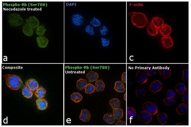 Phospho-Rb (Ser788) Antibody in Immunocytochemistry (ICC/IF)