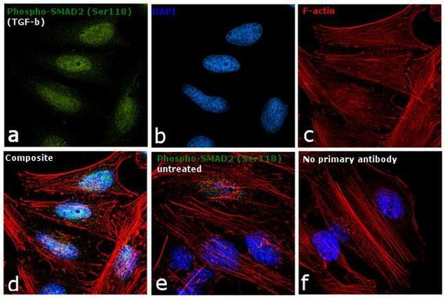 Phospho-SMAD2 (Ser118) Antibody in Immunocytochemistry (ICC/IF)