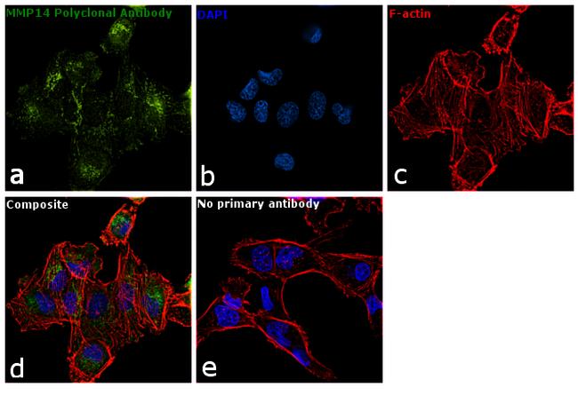 MMP14 Antibody in Immunocytochemistry (ICC/IF)