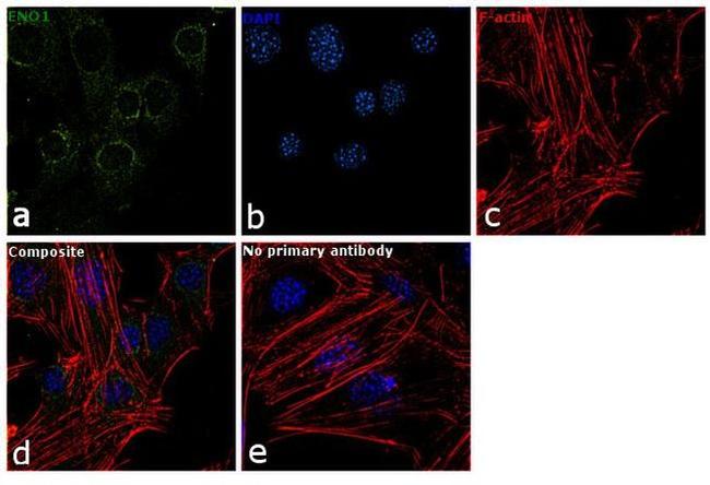 ENO1 Antibody in Immunocytochemistry (ICC/IF)