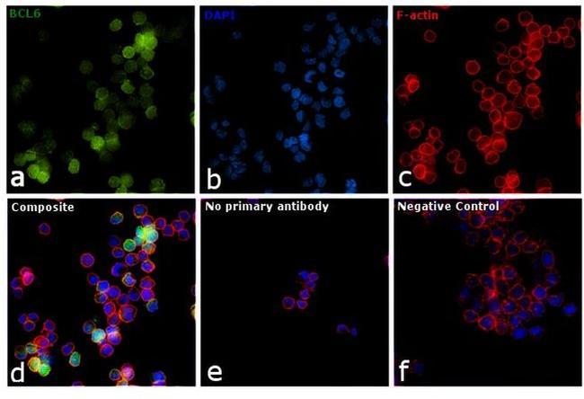 BCL6 Antibody in Immunocytochemistry (ICC/IF)