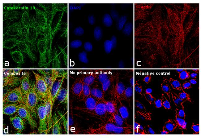 Cytokeratin 18 Antibody in Immunocytochemistry (ICC/IF)