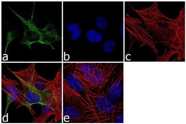 GFAP Antibody in Immunocytochemistry (ICC/IF)