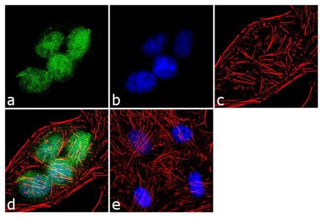 PARP1 Antibody in Immunocytochemistry (ICC/IF)