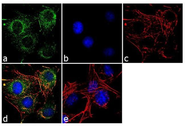 PDGFRA Antibody in Immunocytochemistry (ICC/IF)