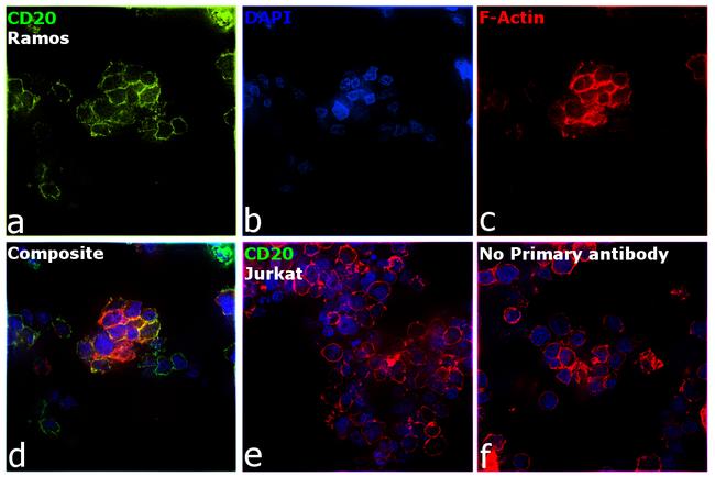 CD20 Antibody in Immunocytochemistry (ICC/IF)