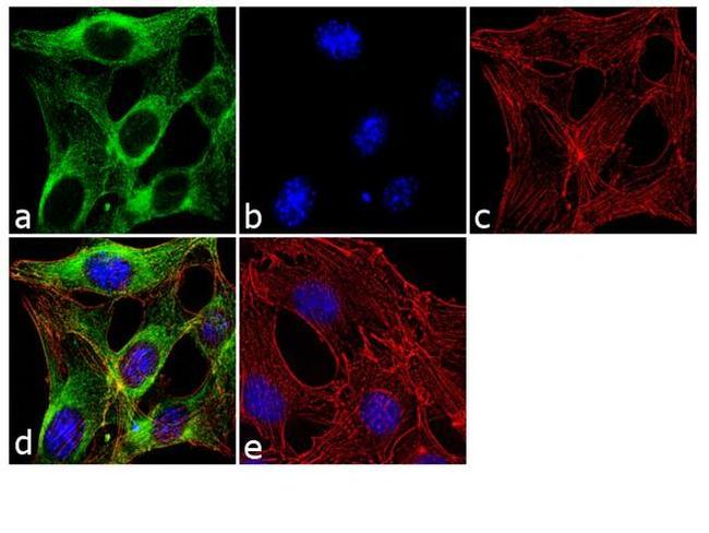 beta Tubulin Antibody in Immunocytochemistry (ICC/IF)