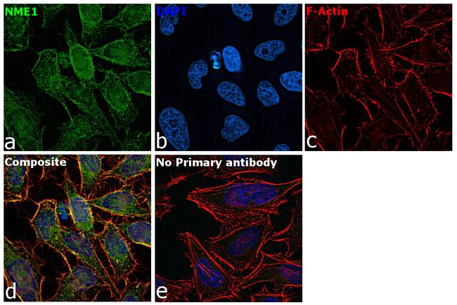 NME1 Antibody in Immunocytochemistry (ICC/IF)