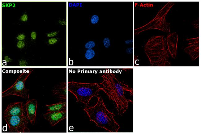 SKP2 Antibody in Immunocytochemistry (ICC/IF)