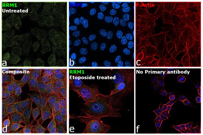 RRM1 Antibody in Immunocytochemistry (ICC/IF)