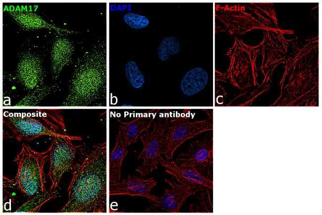 ADAM17 Antibody in Immunocytochemistry (ICC/IF)