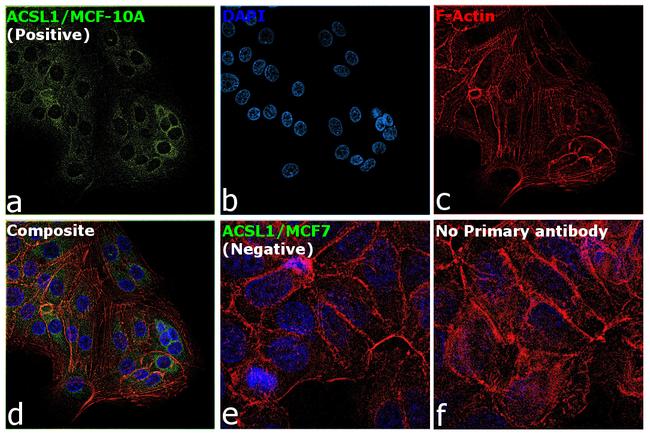 ACSL1 Antibody in Immunocytochemistry (ICC/IF)