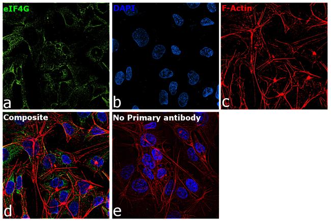 eIF4G Antibody in Immunocytochemistry (ICC/IF)