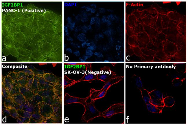 IGF2BP1 Antibody in Immunocytochemistry (ICC/IF)