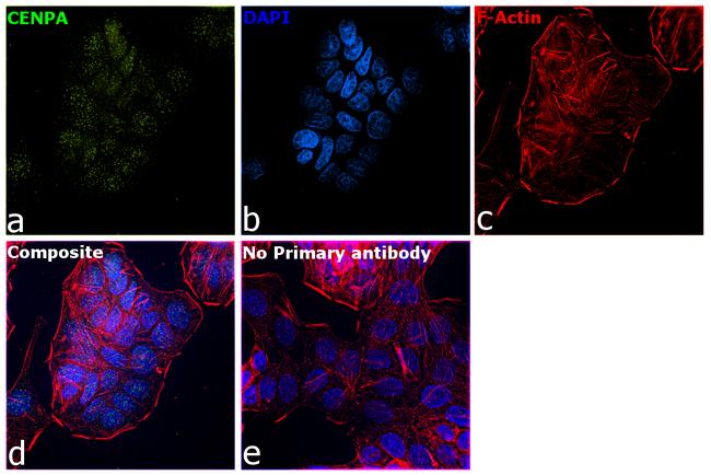 CENPA Antibody in Immunocytochemistry (ICC/IF)