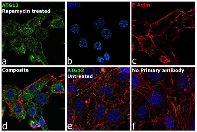 ATG12 Antibody in Immunocytochemistry (ICC/IF)