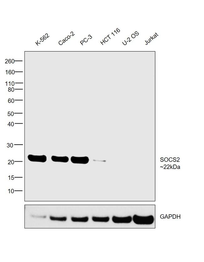 SOCS2 Antibody in Western Blot (WB)