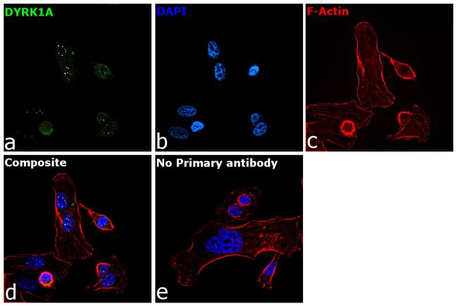 DYRK1A Antibody in Immunocytochemistry (ICC/IF)