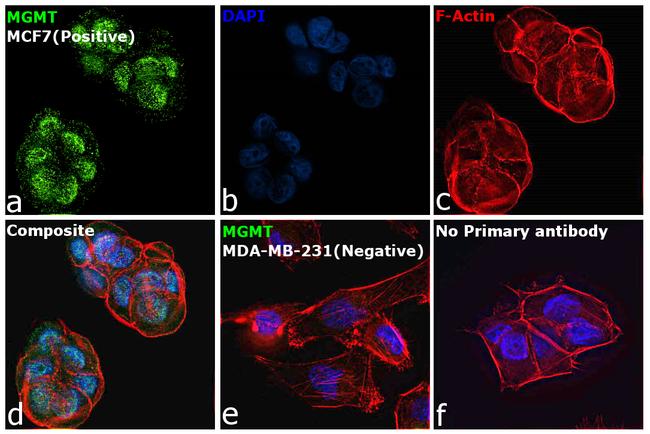 MGMT Antibody in Immunocytochemistry (ICC/IF)