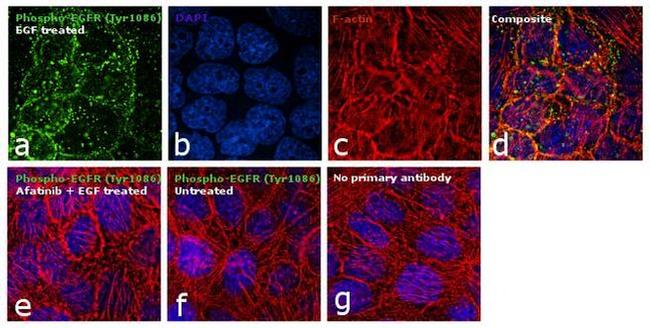 Phospho-EGFR (Tyr1086) Antibody in Immunocytochemistry (ICC/IF)