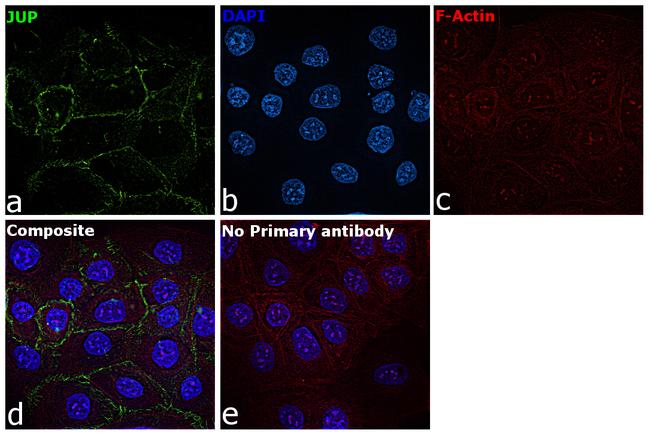 gamma Catenin Antibody in Immunocytochemistry (ICC/IF)