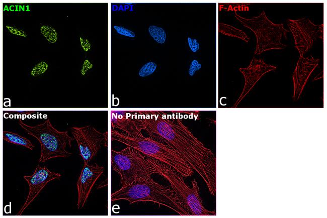 Acinus Antibody in Immunocytochemistry (ICC/IF)