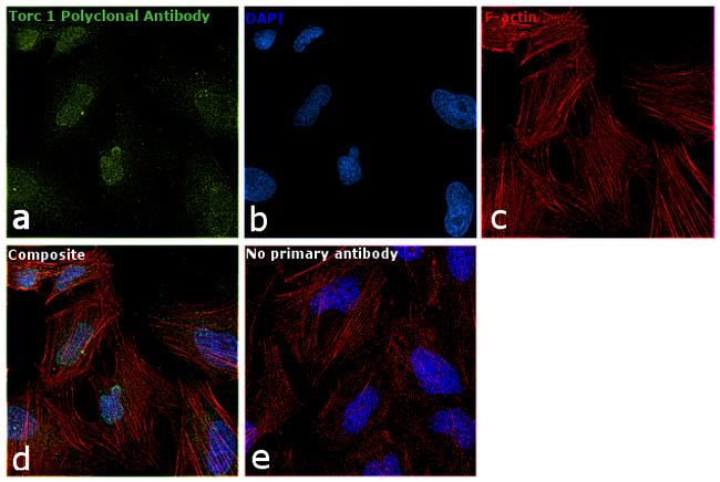 Torc1 Antibody in Immunocytochemistry (ICC/IF)