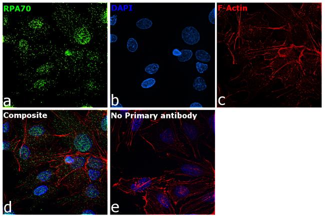 RPA70 Antibody in Immunocytochemistry (ICC/IF)