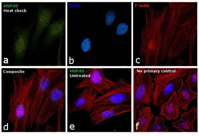 HSP40 Antibody in Immunocytochemistry (ICC/IF)