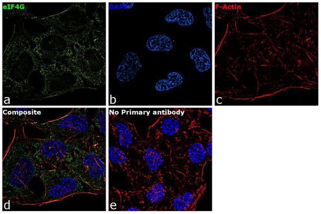 eIF4G Antibody in Immunocytochemistry (ICC/IF)