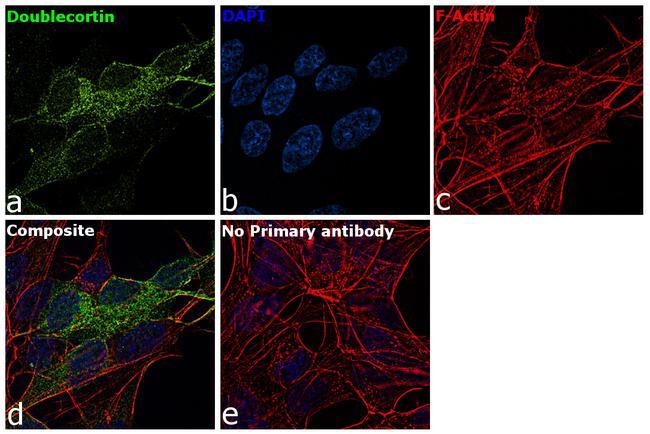 Doublecortin Antibody in Immunocytochemistry (ICC/IF)