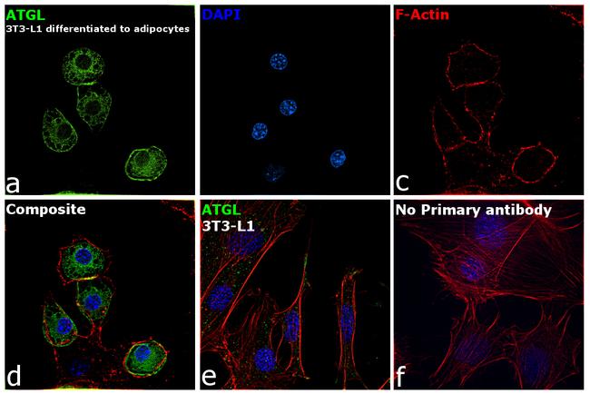 ATGL Antibody in Immunocytochemistry (ICC/IF)