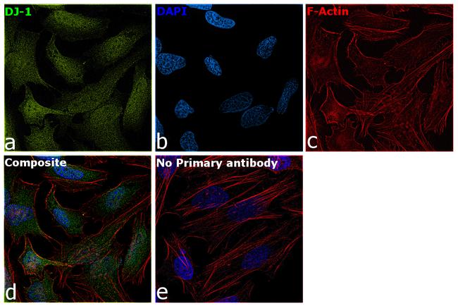 DJ-1 Antibody in Immunocytochemistry (ICC/IF)