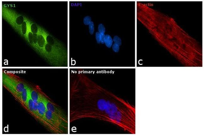 GYS1 Antibody in Immunocytochemistry (ICC/IF)