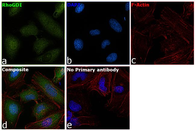 RhoGDI Antibody in Immunocytochemistry (ICC/IF)