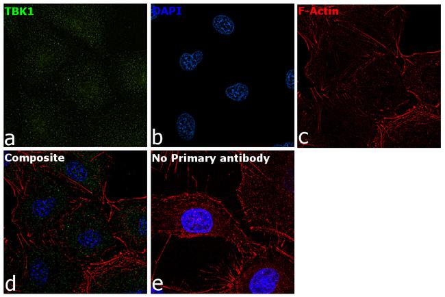 TBK1 Antibody in Immunocytochemistry (ICC/IF)