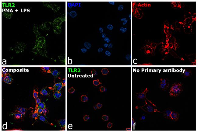 TLR2 Antibody in Immunocytochemistry (ICC/IF)