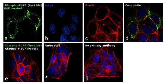 Phospho-EGFR (Tyr1148) Antibody in Immunocytochemistry (ICC/IF)