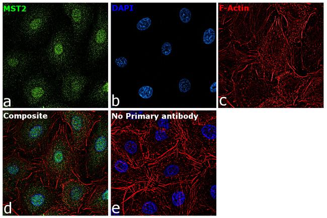 MST2 Antibody in Immunocytochemistry (ICC/IF)