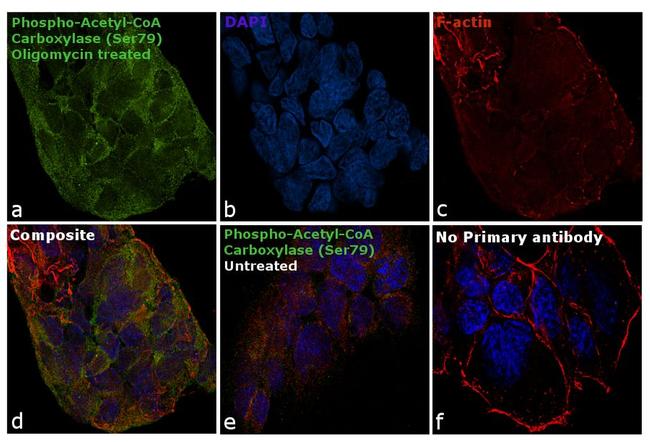 Phospho-Acetyl-CoA Carboxylase (Ser79) Antibody in Immunocytochemistry (ICC/IF)