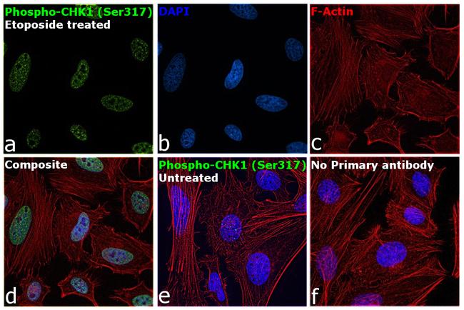 Phospho-CHK1 (Ser317) Antibody in Immunocytochemistry (ICC/IF)