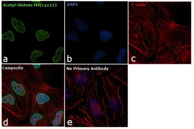 H4K12ac Antibody in Immunocytochemistry (ICC/IF)