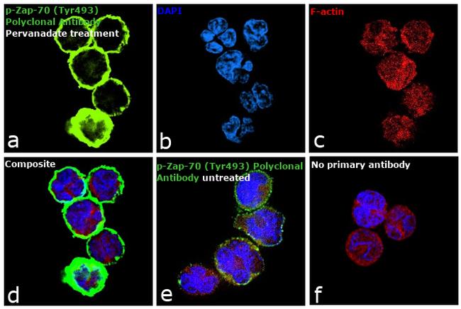 Phospho-Zap-70 (Tyr493) Antibody in Immunocytochemistry (ICC/IF)